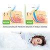 New Extra Strength Anti Snoring Devices - Snoring Solution, 6 PCS Silicone Magnetic Snore Stopper & 8 PCS Premium Silicone Nose Relief Nasal Dilator, Improved Nighttime Sleeping Instant (6 Piece Set)