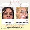 Dark Under Eye Circle Eraser™ Vitamin C+ Serum for Skin-of-Color, Dark Circle Puffiness Wrinkle Hyaluronic Acid Superoxide D, Beauty of the Nile® 1 Oz