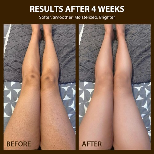 Brewblossom Organic Robusta Coffee Body Scrub 8 oz with Coconut Oil & Shea Butter - Moisturizing and Exfoliating Body, Face, Hand, Foot Scrub - Cellulite, Fight Stretch Mark, Fine Line, Wrinkle