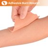 MedEduQuest Burn Wound Packing Trainer, Burn Moulages Kit, Adhesive Skin Burn Wound Trainer for Wound Care Training, Burn Wound Training Model
