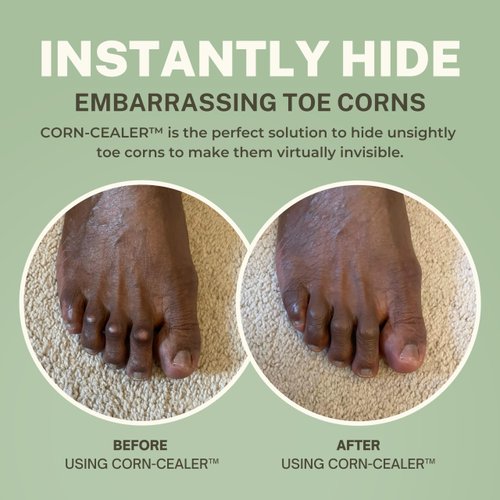CORN-CEALER Toe Makeup That Instantly Hides Toe Corns | Water Resistant | Foot Care | Body Makeup | Scar Makeup | Tattoo Cover up (NUTMEG)