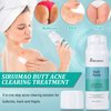 Butt Acne Clearing Treatment (3.4 OZ), Butt Acne Treatment for Clearing Acne, Pimples, Blackheads, Zits and Razor Bumps for the Buttocks, Thigh and Back Acne