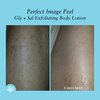 Perfect Image Gly + Sal Exfoliating Body Lotion, 8% Glycolic Acid and 2% Salicylic Acid Lotion Enhanced with Green Tea, Papaya, Bearberry, Licorice and Amino Complex
