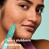 Hero Cosmetics Pimple Correct Acne Clearing Gel Pen - Maximum Strength 2% Salicylic Acid, Derm-Tested Formula for Current and Future Zits (1 Count)