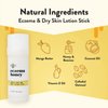 ECZEMA HONEY Gentle Face & Body Lotion Stick - Moisturizing Colloidal Oatmeal Hand Cream for Extremely Dry Skin - Eczema Lotion Helps Psoriasis, Dermatitis & More (2.2 Oz)