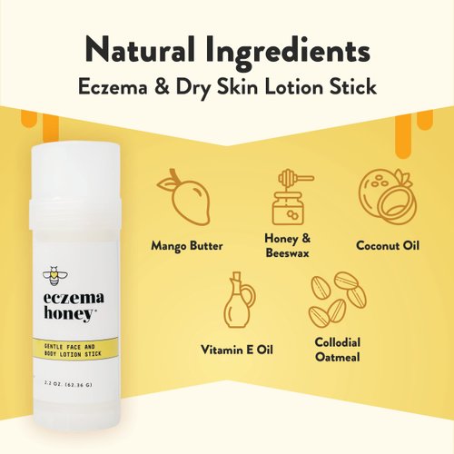ECZEMA HONEY Gentle Face & Body Lotion Stick - Moisturizing Colloidal Oatmeal Hand Cream for Extremely Dry Skin - Eczema Lotion Helps Psoriasis, Dermatitis & More (2.2 Oz)