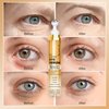 Scosvvi Caffeine Eye Serum For Dark Circles, Eye Cream For Anti Aging, Puffiness & Fine Lines With Ice Roller for Puffy Eyes & Under Eye Bags, Eye Skin Care For Women & Men