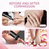 Ranrose Multifunction Electric Callus Remover for Feet - 2 in 1 Rechargeable Portable Electric Foot File with Replaceable Nail Drill Bit - 6 Adjustable Speeds Professional Pedicure Tools for Feet