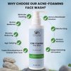 SBS STOW BULK SUPPLY Acne Foaming Face Wash — Oil-Controlling Facial Cleanser for Blackheads & Pimples — Gentle & Moisturizing Facewash to Reduce Redness (150g/5.3oz)