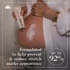 Nemah - Stretch Mark Cream for Pregnancy - Pregnancy Stretch Mark Prevention & Reduction, Postpartum Stretch Mark Cream with Vanistryl, Shea Butter, & Macadamia Oil - Vegan & Cruelty-Free - 3.5 oz.