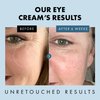Under Eye Cream for Dark Circles and Puffiness - Eye Repair Cream Dark Circles Under Eye Treatment - Eye Cream Anti Aging Under Eye Serum Moisturizer Puffy Eyes Treatment Dark Circle