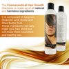 Rozge Hair Growth Shampoo for Thickening with Biotin, 1 fluid ounce, for Men and Women, Anti Hair Loss Treatment, Vitalize Hair System
