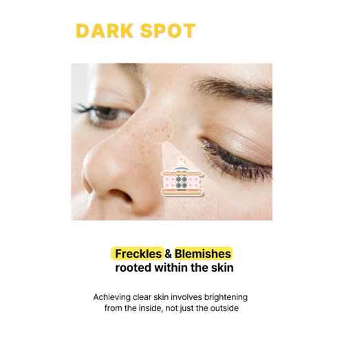 Acropass Spot Care Microcone for Dark Spots - Targeted Post-Blemish Treatment Patch, Dermatologist Approved & Gentle on Skin, Cruelty-Free (6 Patches + 6 Cleansers)