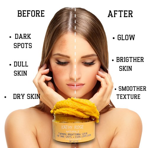 Turmeric Exfoliating Body Scrub, Exfoliating Face & Body Scrub with Turmeric for Even Complexion, Gentle Body Exfoliator for Dry Skin, yellow, 5.7 Ounce (Pack of 1)