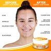 HERBOGANIC Turmeric Peel Off Mask | For Skin Care | For Fresher Look | Spa Quality | All Natural Mask | 5.30 oz