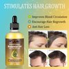 Hair Growth Oil,Rosemary Hair Regrowth Serum,Scalp & Hair Strengthening Oil Products For Hair Thinning & Loss, Dry Damaged Hair,Beard,For Men Women (60ml)