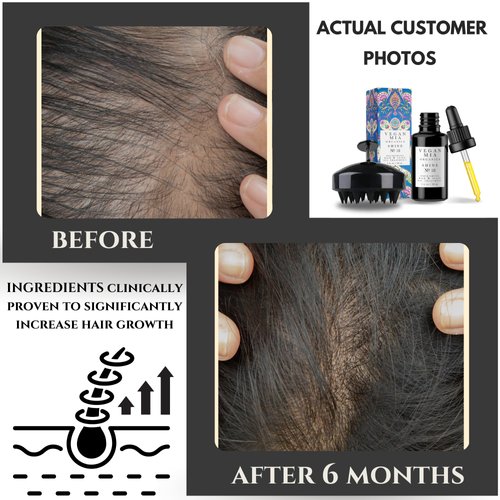 USDA Organic Hair Oil Treatment for Intense Nourishment, Dry Scalp Relief, and Hair Growth Promotion - Silicone Head Massager for Relaxation and Exfoliation