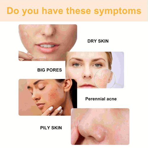 Orange Exfoliating Gel, orange exfoliating gel scrub,Deep Cleansing Moisturizing Facial Exfoliator, Size 50ml, 1.7 Fl Oz (2 PCS)