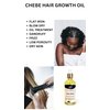 LE SHEA Chebe Hair Oil 27 in 1 Tea Tree & Peppermint Hair Growth Oil Moisturizer, Root Stimulator, Itchy Scalp Treatment with Olive Oil, Jamaican Black Castor Oil, Amla Oil, Apricot, Hempseed Oil Dry Damaged Hair Beard Locs Twists Braids Glass Bottle 4 oz
