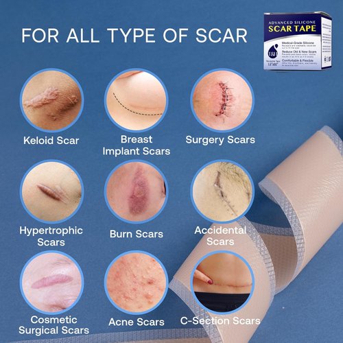 Silicone Scar Tape for Surgical Scars: Advanced Silicone Scar Sheets - Reduces The Appearance of Scars from C-Section, Surgery, Burns, Keloid and Stitches - Made with Silicon and Collagen 4 x 150cm