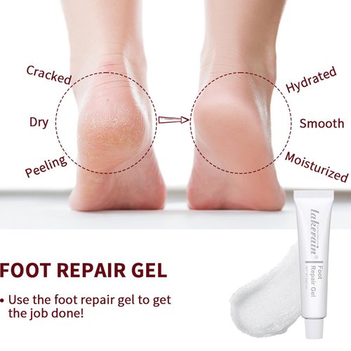 HWSHQY OO Foot Repair Gel,Intensive Foot Repair Foot Cream for Cracked Heels and Dry Feet,Moisturizing Hydrating Foot Repair Cream,Heel Repair Dry Foot Cream,Cracked Feet Treatment