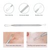 Professional Blackhead and Blemish Remover -Pimple Comedone Removal 2-in-1 Extractor Tool -by La Chat