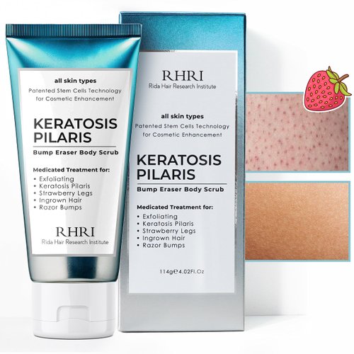 KP Bump Eraser Body Scrub, Keratosis Pilaris Treatment, Strawberry Legs Treatment for Women, Bump...