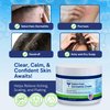 Itch Cream for Itchy Skin Relief - Moisturizing Cream & Face Lotion for Women - Redness Relief for Face & Body Cream - Hydrating Face Cream for Dry Skin & Itchy Scalp Relief - Anti Itch Lotion (4oz)