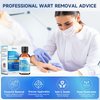 Ragkun Fast-Acting Skin Tag Remover Wart Remover with Salicylic Acid, Wart Removal for Women Men, Wart Freeze Off for Plantar Wart,Flat,Common, Corn,H Wart, Callus 30ML