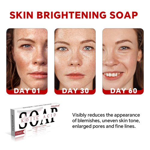 ORIENTLEAF Kojic Acid Soap, Turmeric Soap Bar, Fresh Citurs Scent, Gentle for face and body with Vitamin C, Shea Butter, Retinol, Olive Oil, Collagen (3 PACK)