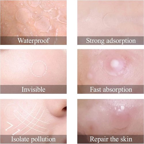 Generic Acne Patch Kit, Anti-Acne Patch for Oily Skin, Pack of 72