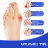 Toe Corrector Toe Separator Bunion Splint 【2024 Updated】 Hallux Valgus Bunion Big Toes Corrector Set Bunion Brace Bunion Exercise Strap Orthopedic Kit Bunion Pain Relief (free, Blue)