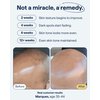 Remedy for Dark Spots – Discoloration Treatment For Face with Retinol, Glutathione, Niacinamide, Mandelic Acid, Kojic Acid and Tranexamic Acid – By Dermatologist Dr. Shah