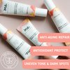 Mudita Earth Pineapple and Rosehip Vitamin C and Niacinamide Serum - Organic Vitamin C E Ferulic Serum for Acne Scars Dark Spots - Hyperpigmentation Serum for Skin Brightening and Rejuvenation