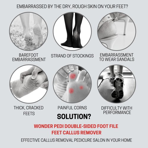 Made in Germany Double Sided Foot File Callus Remover, Stainless Steel and Emery Sides Feet Scrubber, Professional Pedicure Foot Care Tool Rasp, Long Lasting Foot Buffer, Heel Scraper, Wonder Pedi