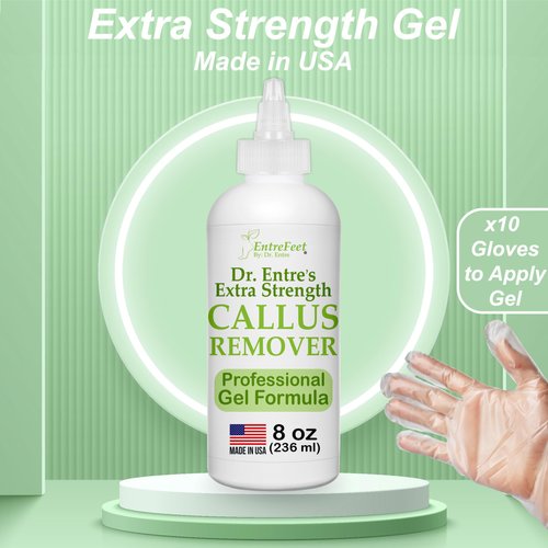 Dr. Entre's Callus Remover Gel Kit for Feet: Foot File, Pumice Stone, 5 Glove Pairs for Gel Application, Spa Kit, Foot Care, Pedicure Tools, Scrubber, 8oz