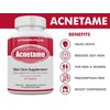 Acnetame Acne Pills- Vitamin Supplements for Acne Treatment- Natural Clear Skin from Hormonal Cystic Pimples- Oily Skin Vitamins Pill for Women, Teen, Men, & Adults 60 Tablets