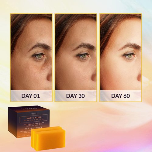 VALITIC 2 Pack Kojic Acid Vitamin C & Retinol Soap Bars for Dark Spot & A Pair Of Black Exfoliating Gloves for Body Scrubs