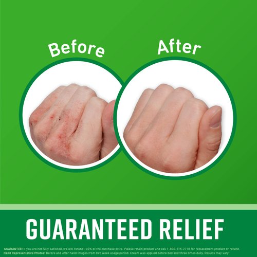 O'Keeffe's Working Hands Hand Cream, Relieves and Repairs Extremely Dry Hands, 7 oz Tube (Pack of 1)