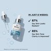 IT Cosmetics Bye Bye Dark Spots 4% Niacinamide Serum - Visibly Reduces Dark Spots & Improves Skin Clarity In 8 Weeks - Facial Serum with 1% Ethyl Vitamin C - For All Skin Types - 1 Fl. Oz