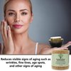 Mountain Top Retinol Facial Moisturizer 1.7oz, For Wrinkles, Age Spots, Fine Lines, and Other Signs of Aging - Made with 24k Gold, Aloe Vera, Green Tea, Argan Oil, Shea Butter, Vitamin E