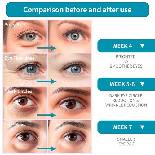 LANBENA Eye Cream for Wrinkles, Anti-Aging Eye Cream with Hyaluronic Acid, Reduce Fine Lines, Firm Eye Skin, Puffy Eyes and Dark Circles Treatments