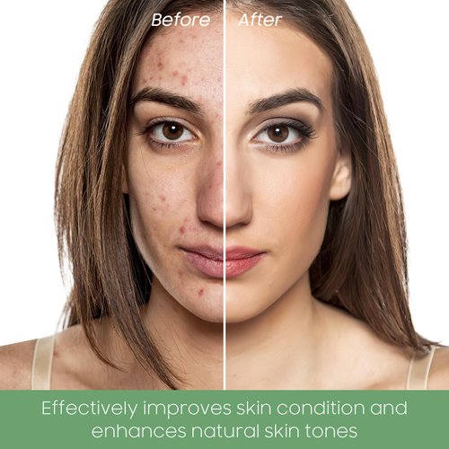 PAINISTIC Green Tea Clay Face Mask - Green Tea Skin Care for Removes Blackheads Mask, Pore Cleansing Green Tea Clay Skin Mask, Deep Cleanse Mask for All Skin Types (1 PCS)