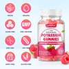 softbear Potassium Citrate 1000mg Gummies – Suagr Free Potassium Gummies for Muscle Support & Electrolyte Balance – Potassium Supplement for Women & Adults, Vegan, Raspberry Flavor (60 Count)