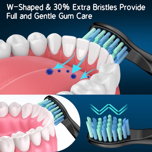 Replacement Toothbrush Heads for Fairywill, Electric Brush Heads Replacement for FW-507/508/515/551/917/959/D1/D3/D7/D8/2011, 10 Pack, Black…