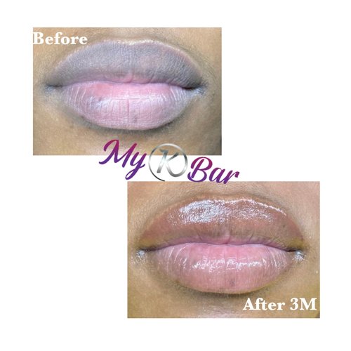 MyKBar All natural Turmeric and Honey Lip Balm | Lip lightener| Smokers lips |Dark lips