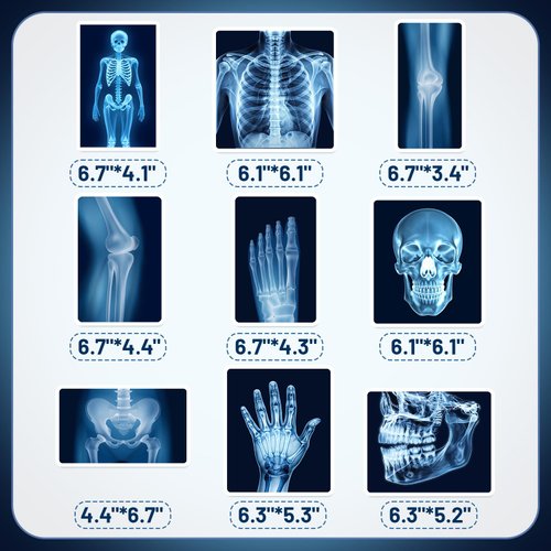 9Pcs Radiology X Ray Honeycomb Centerpieces Radiology Party Favors Birthday Party Decorations X Ray Centerpieces Decorations Supplies for Radiology Xray Doctor Medical Theme Party Baby Shower Supplies