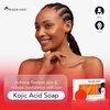 Kojie San Skin and Body Soap – Original Kojic Acid, Dark Spot Remover Soap Bar with Coconut & Tea Tree Oil – 3 x 65g Bars