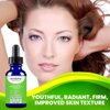 ActivePur Tea Tree Serum Oil for Acne Facial Skin Serum 20% Vitamin C Hyaluronic Acid Retinol helps in Hyperpigmentation Wrinkles Anti Aging Dark Spots Blemishes Acne Scars (2 Oz/60 ml)
