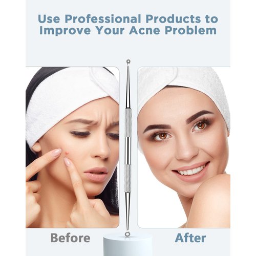 TAYTHI Blackhead Remover Tool, Pimple Popper Tool Kit, Blackhead Extractor Tool for Face, Extractor Tool for Comedone Zit Acne Whitehead Blemish, Stainless Steel Extraction Tools